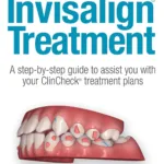 Insider's Guide to Invisalign Treatment: A step-by-step guide to assist you with your ClinCheck treatment plans 2 Insider's Guide to Invisalign Treatment: A step-by-step guide to assist you with your ClinCheck treatment plans Kindle Edition