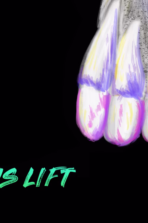 Implant Ninja Introduces Sinus Lifting Master