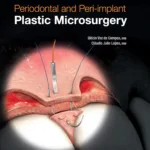 Periodontal and Peri-implant Plastic Microsurgery: Minimally Invasive Techniques with Maximum Precision 2 Periodontal and Peri-implant Plastic Microsurgery: Minimally Invasive Techniques with Maximum Precision Hardcover – February 1, 2021
