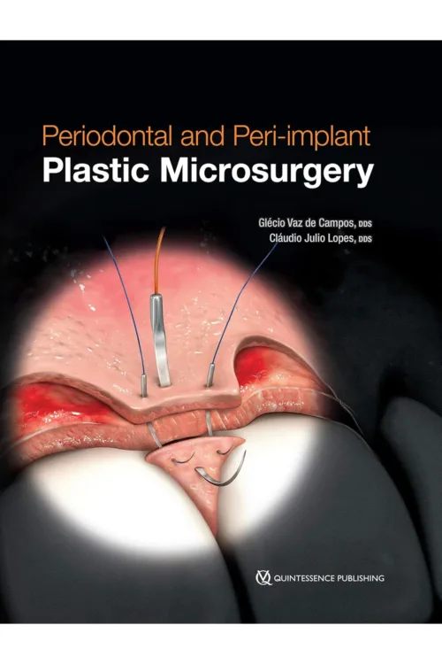 Periodontal and Peri-implant Plastic Microsurgery: Minimally Invasive Techniques with Maximum Precision Hardcover – February 1, 2021