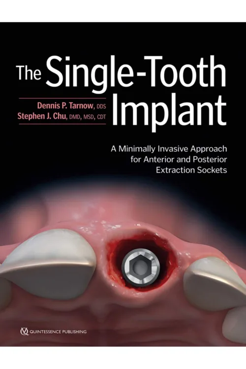 The Single-Tooth Implant: A Minimally Invasive Approach for Anterior and Posterior Extraction Sockets 1st Edition