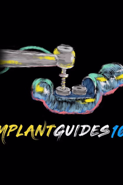 Ninja Implant Guides 101